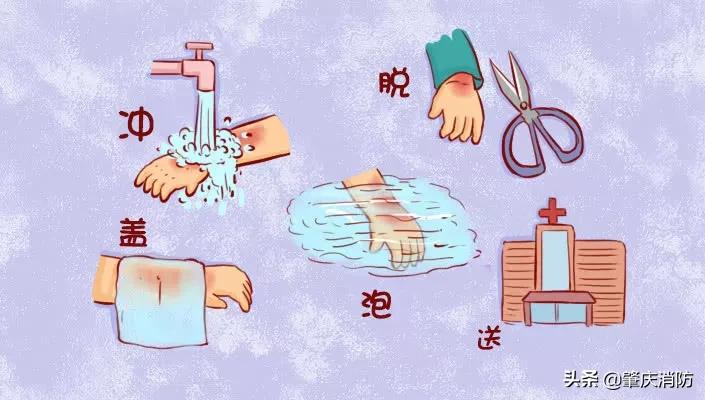 女子拔火罐被烧伤后续,明星拔火罐烧伤事件