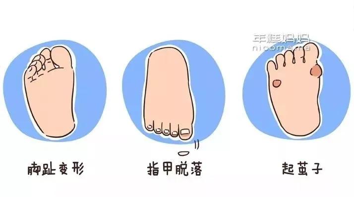 夏天不能让孩子穿的四种鞋子,夏天不能给孩子买鞋子