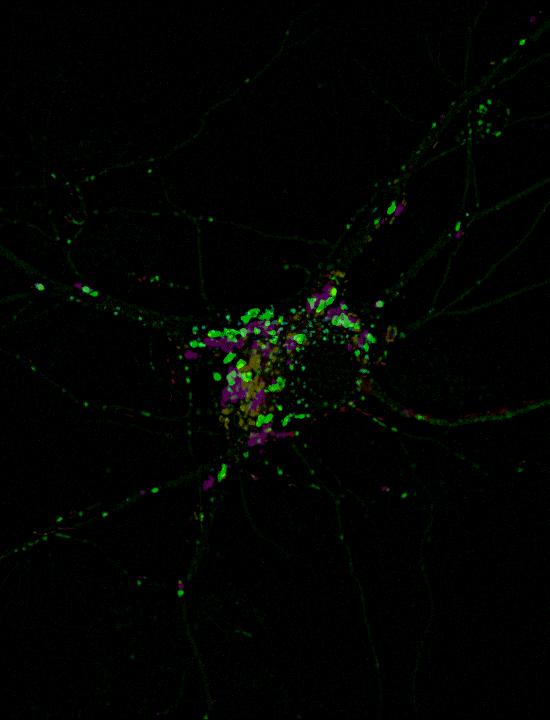 联想记忆的练习与应用,联想法记忆作业