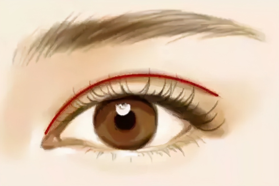 双眼皮不要盲目跟风,别割双眼皮