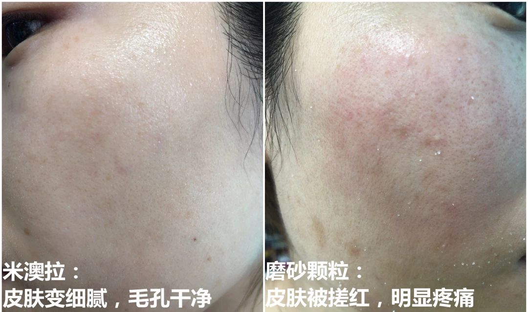 孙艺珍的颜值变化,孙艺珍颜值巅峰的笑容