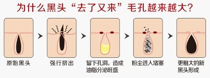 如何解决校园霸凌问题,如何解决水烧开有白色沉淀物