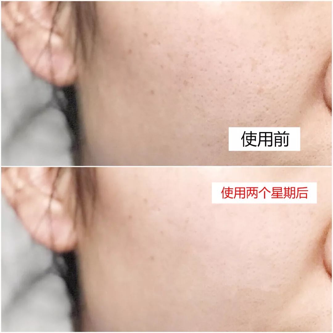 好用的美白面膜平价推荐,超好用平价美白面膜推荐