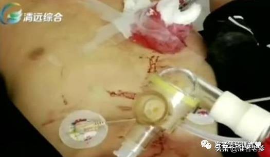 学生打篮球起争执被家长砍死,湖南中学生篮球打架