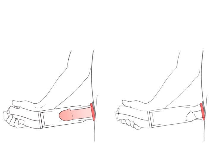 「勃起功能障碍」可以做这种康复治疗,再不了解就晚了