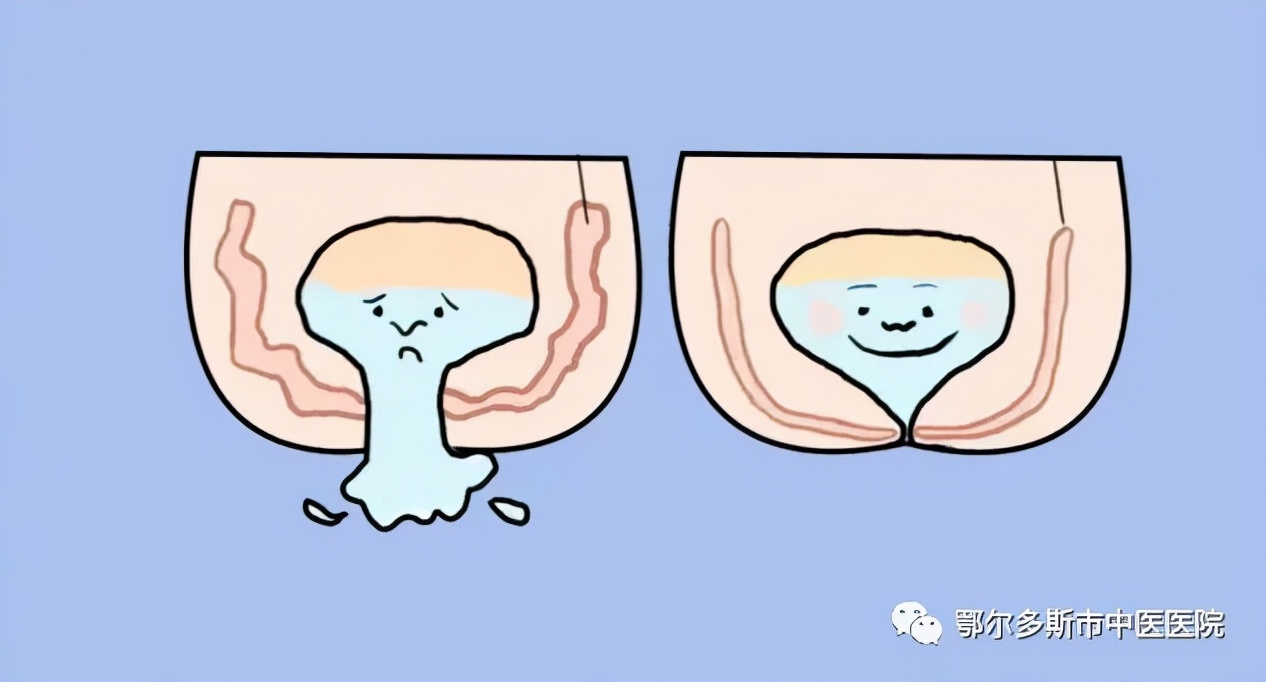 漏尿属于严重疾病吗,如何判断漏尿严重程度