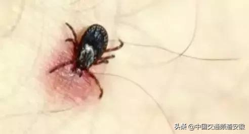 安医大二附院最新消息今天,安医大二附院住院部最新消息