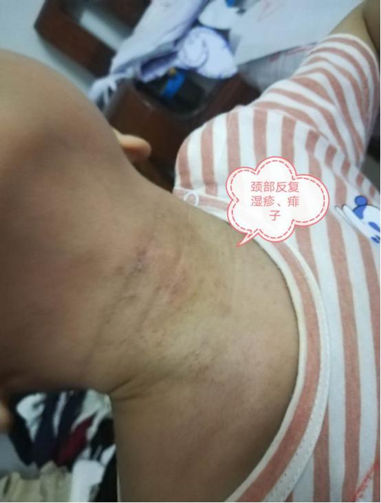 反复腹泻大便不成形,小孩拉肚子肠道功能紊乱多久能好