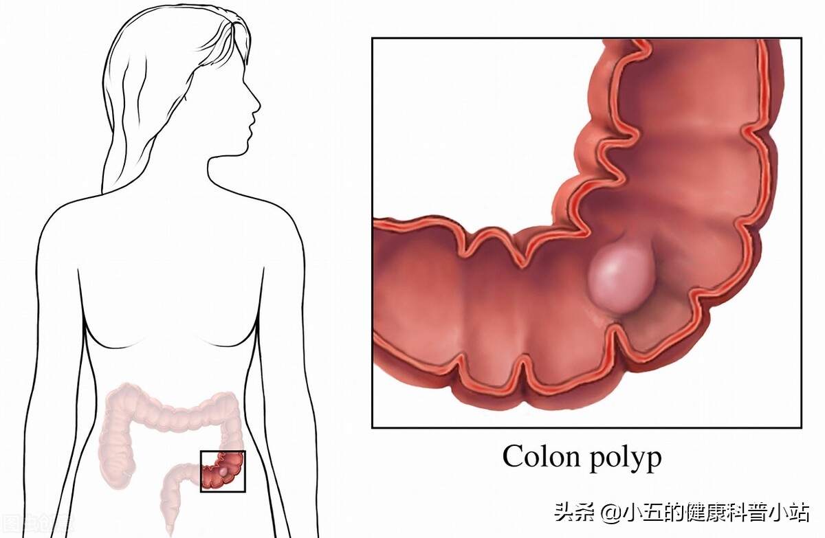 润肠通便茶,润肠茶与肠清茶有什么区别