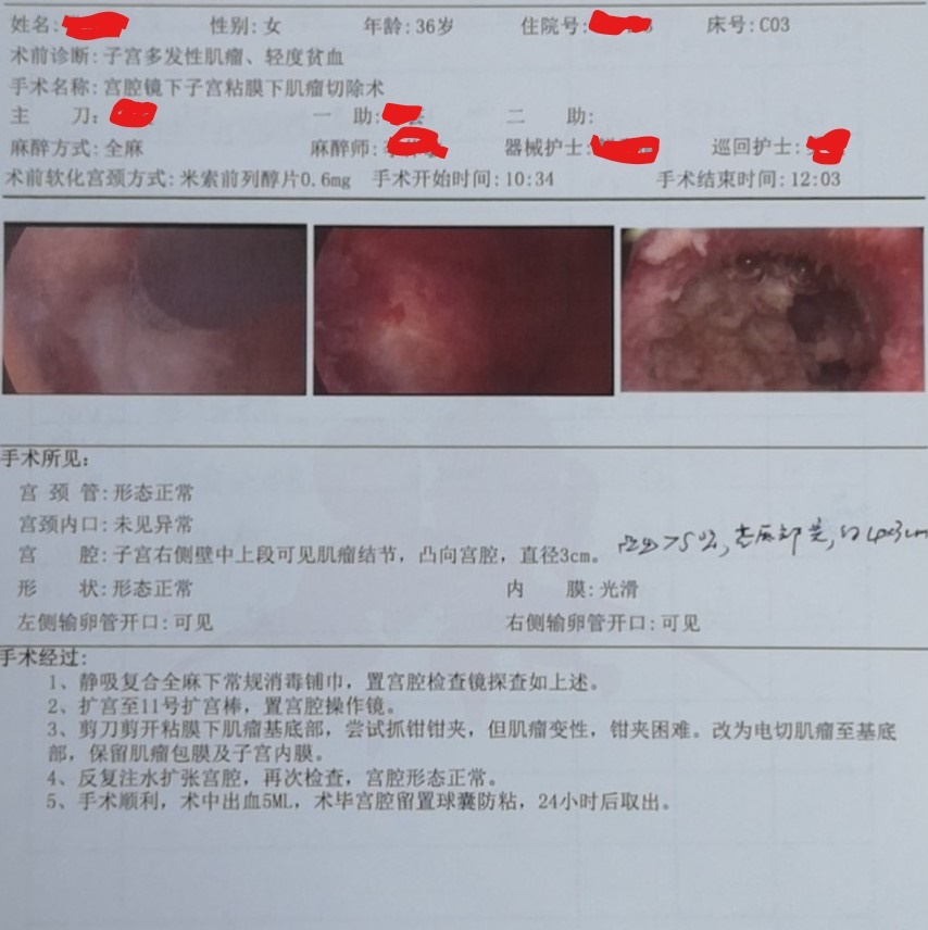 子宫粘膜下肌瘤的危害有哪些,子宫粘膜下肌瘤的危害