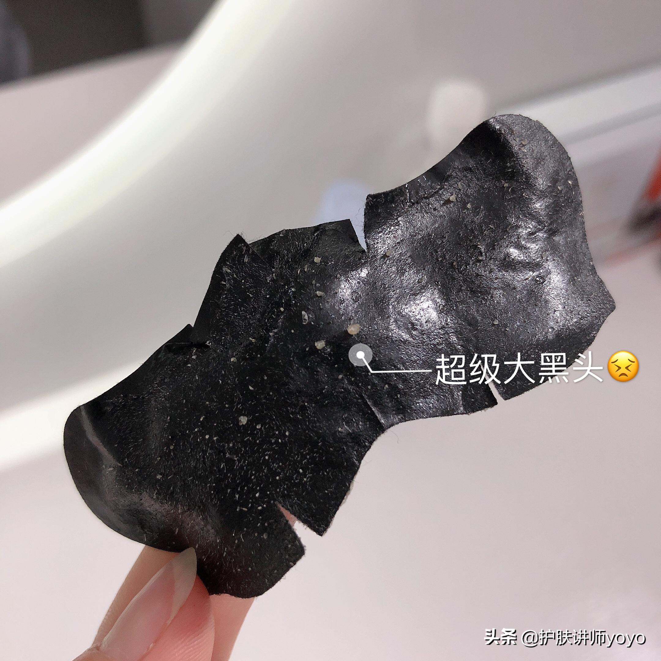 去黑头护肤正确过程,挤黑头之后怎么护肤