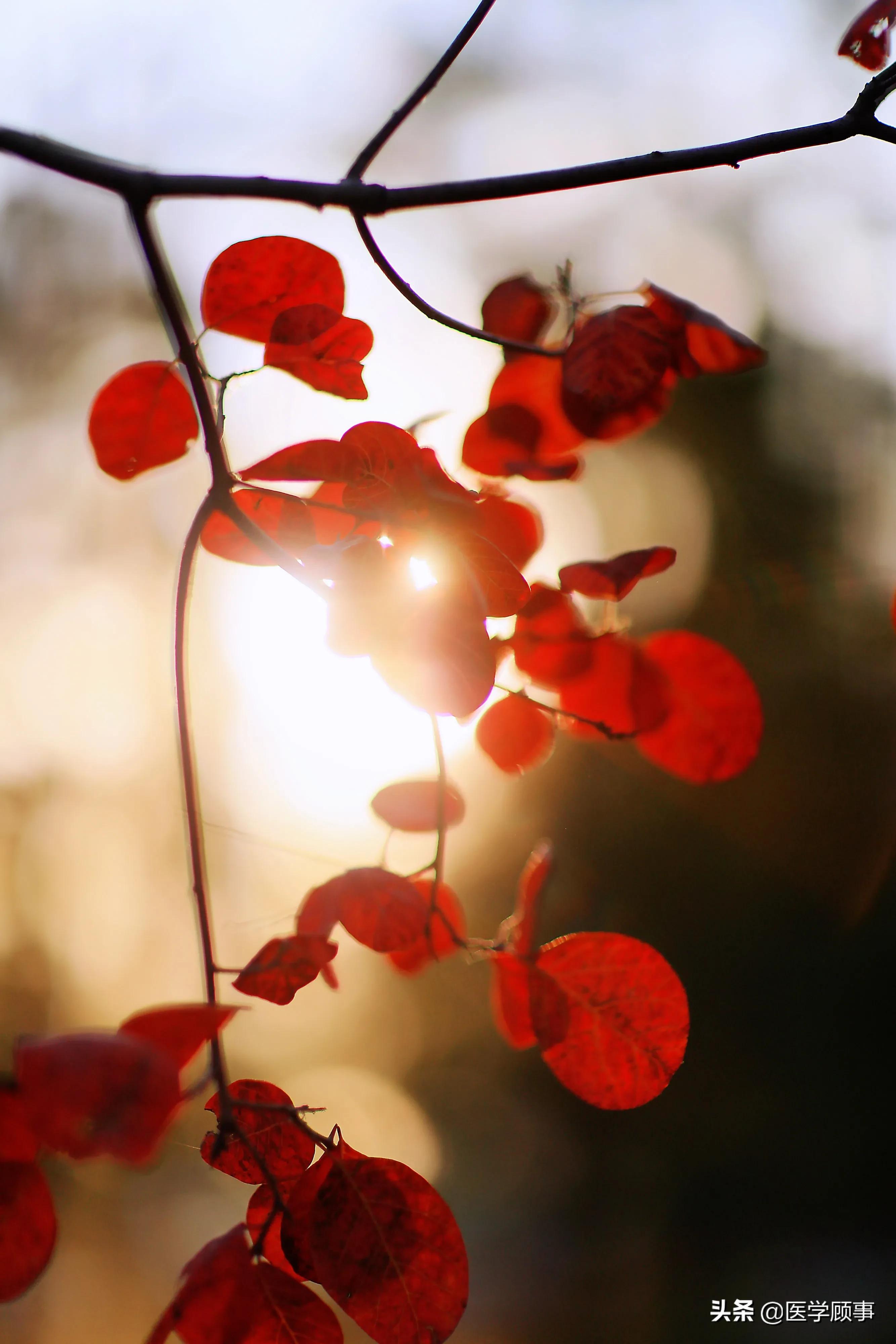 前庭性偏头痛简介,前庭性偏头痛诊断标准更新