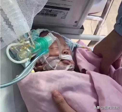 早产儿在nicu里面是怎样的,他一出生就被死神夺走一切