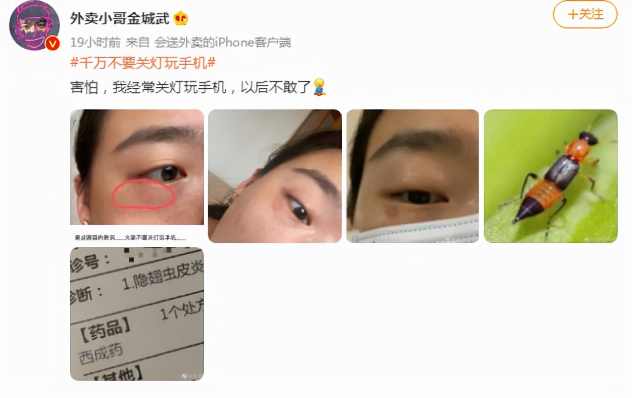 40岁女人脸被隐翅虫烧伤毁容吗,隐翅虫碰到脸上了是不是会毁容