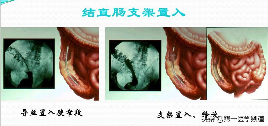「医影传声」上海交通大学医学院附属瑞金医院卢湾分院放射科主任