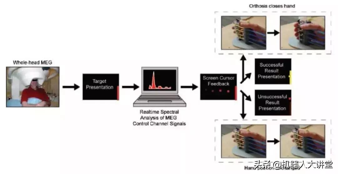 脑机接口用于康复治疗,念通智能
