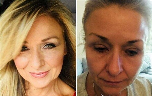 欧莱雅卸妆油和zero卸妆膏,欧莱雅花萃净柔卸妆膏100ml