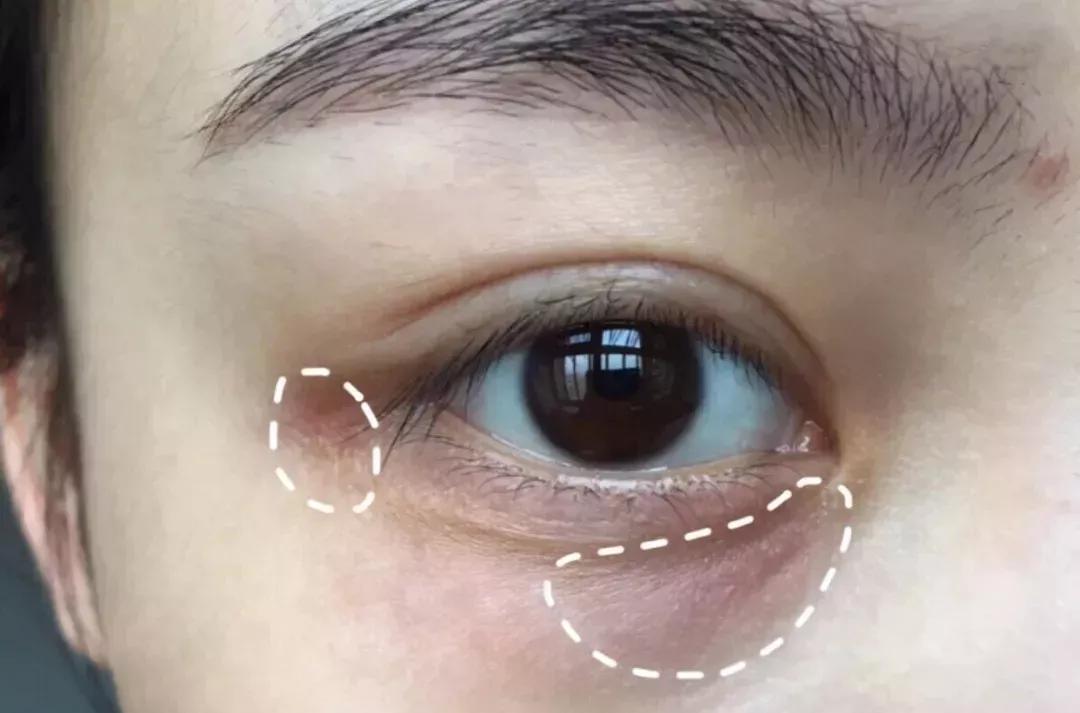 雅诗兰黛日本产的眼霜,用了雅诗兰黛皱纹更明显了