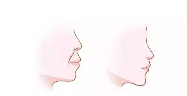 嘴型丑的怎样让嘴唇变得好看,嘴型不好看怎么练才能矫正