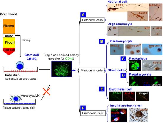脐血干细胞疗法,脐带血治一型糖尿病