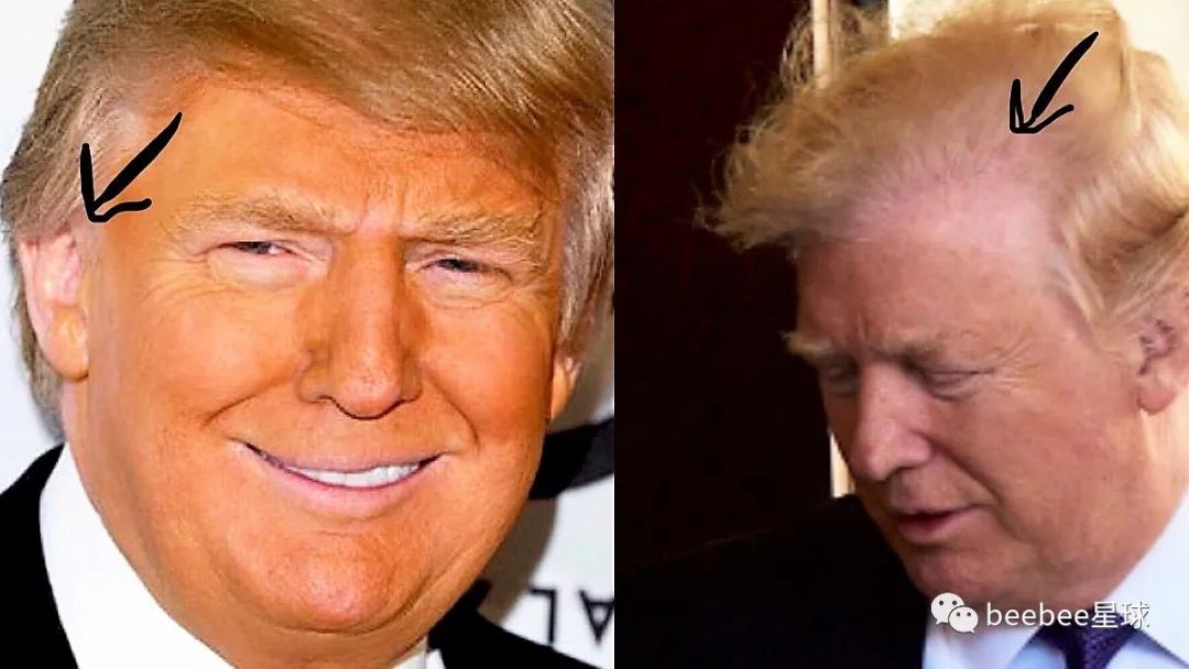 为什么老特的眼袋是白色的？