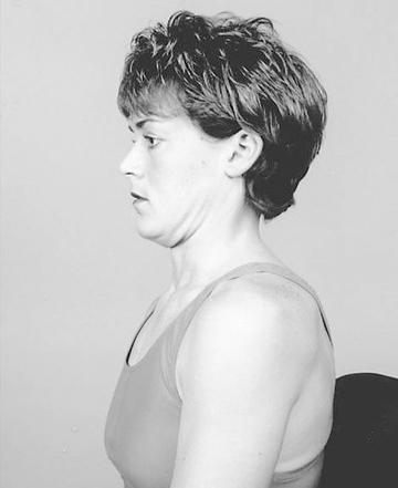 脖子前伸驼背怎么矫正,矫正脖子前伸