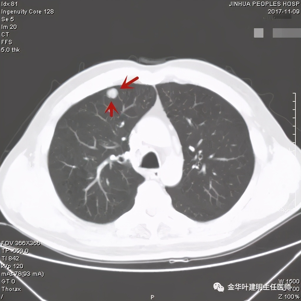 误诊报告图片,误诊案例及案例分析