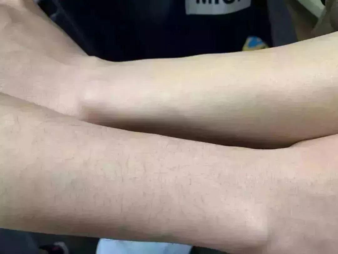 强烈推荐，永久脱毛，好评超多，拿走不谢