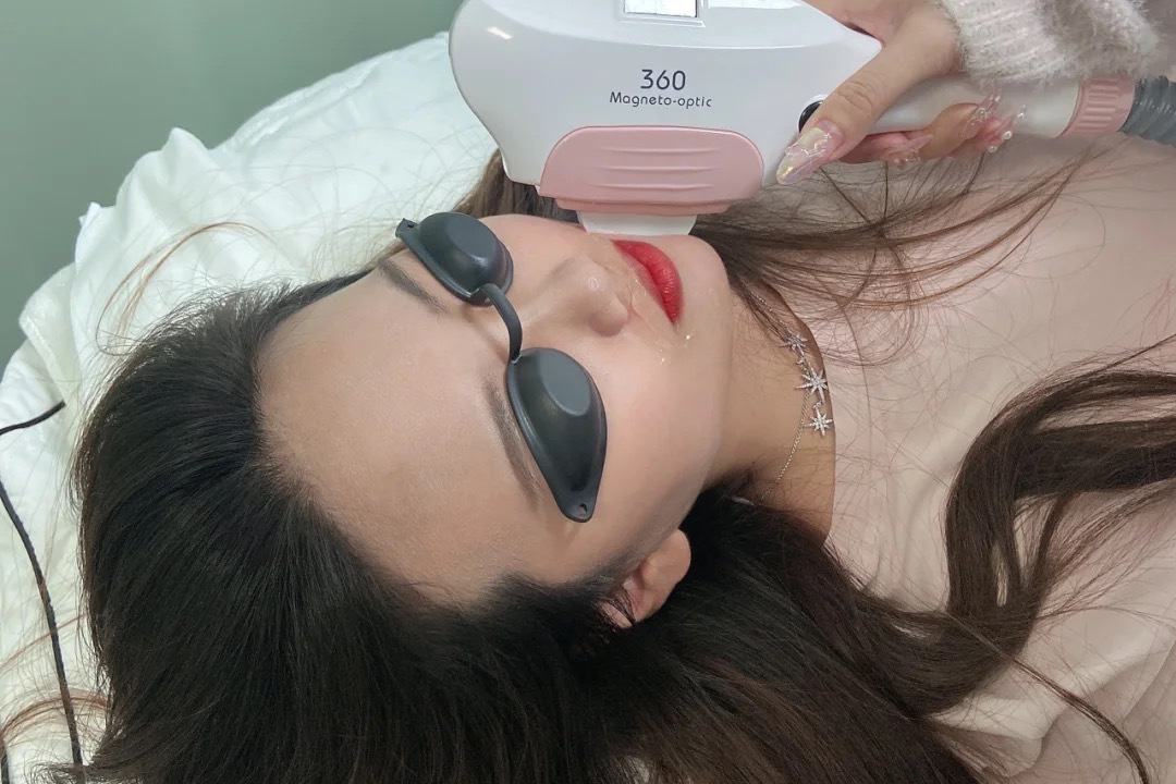 女生长胡子怎么去除最简单的方法,女性嘴角边长胡子是怎么去除