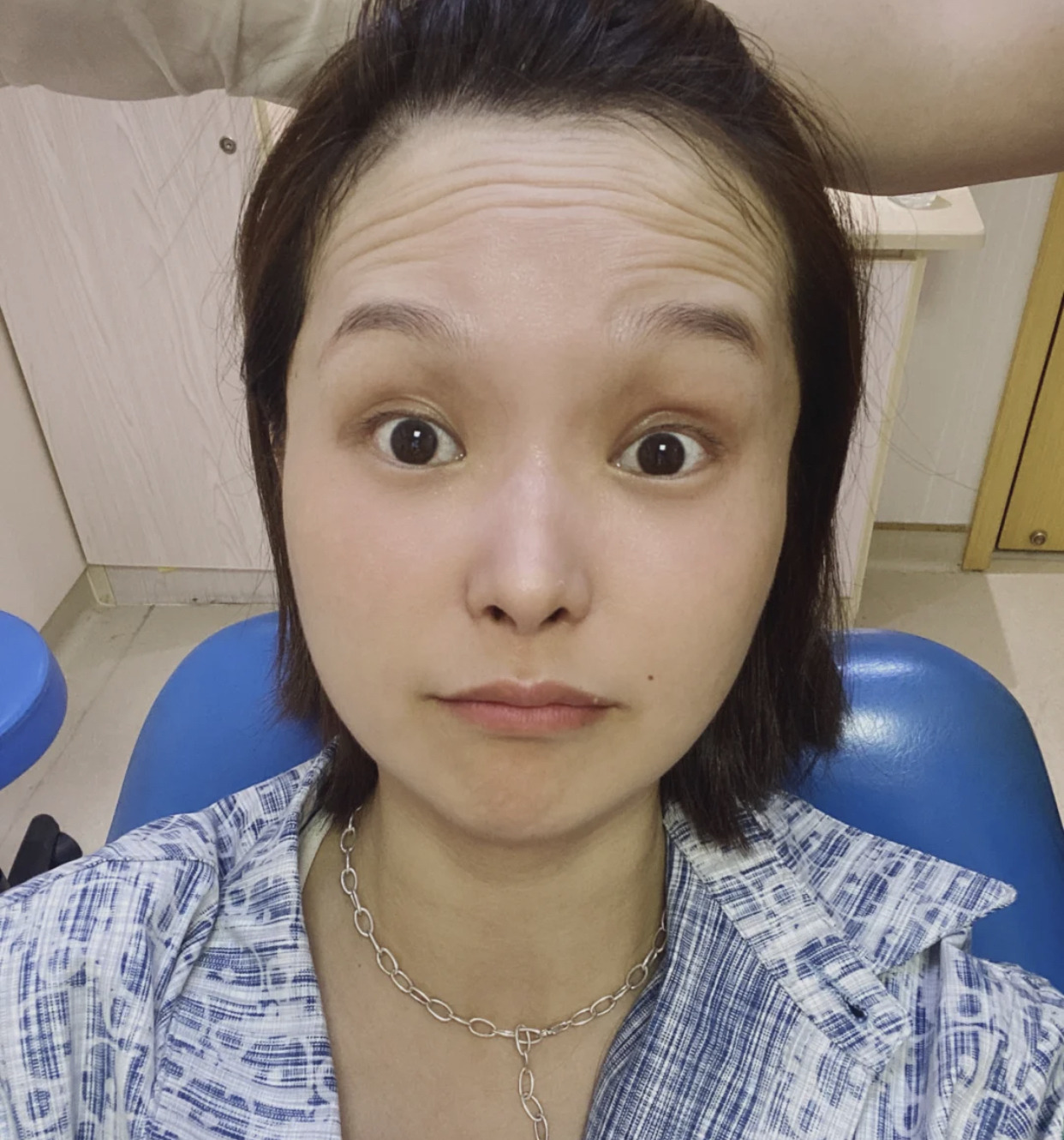 眼尾有皱纹怎么治疗,眼尾沟里面有皱纹怎么办