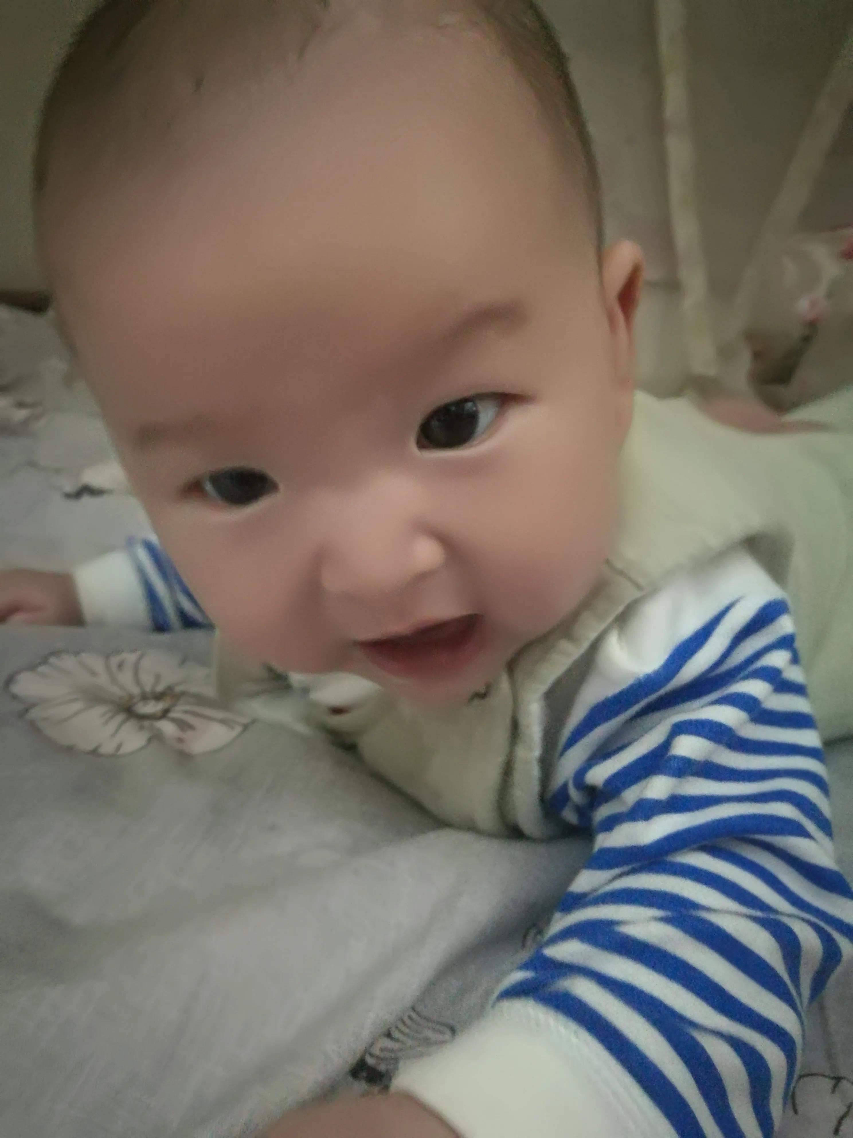 宝宝从出生要经历黄疸胀气,宝宝为什么会黄疸和湿疹