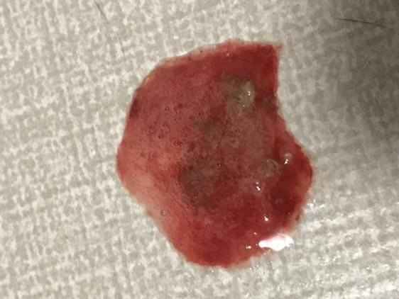 猫吐出的黄水里面有寄生虫,猫呕吐吐出虫子怎么办