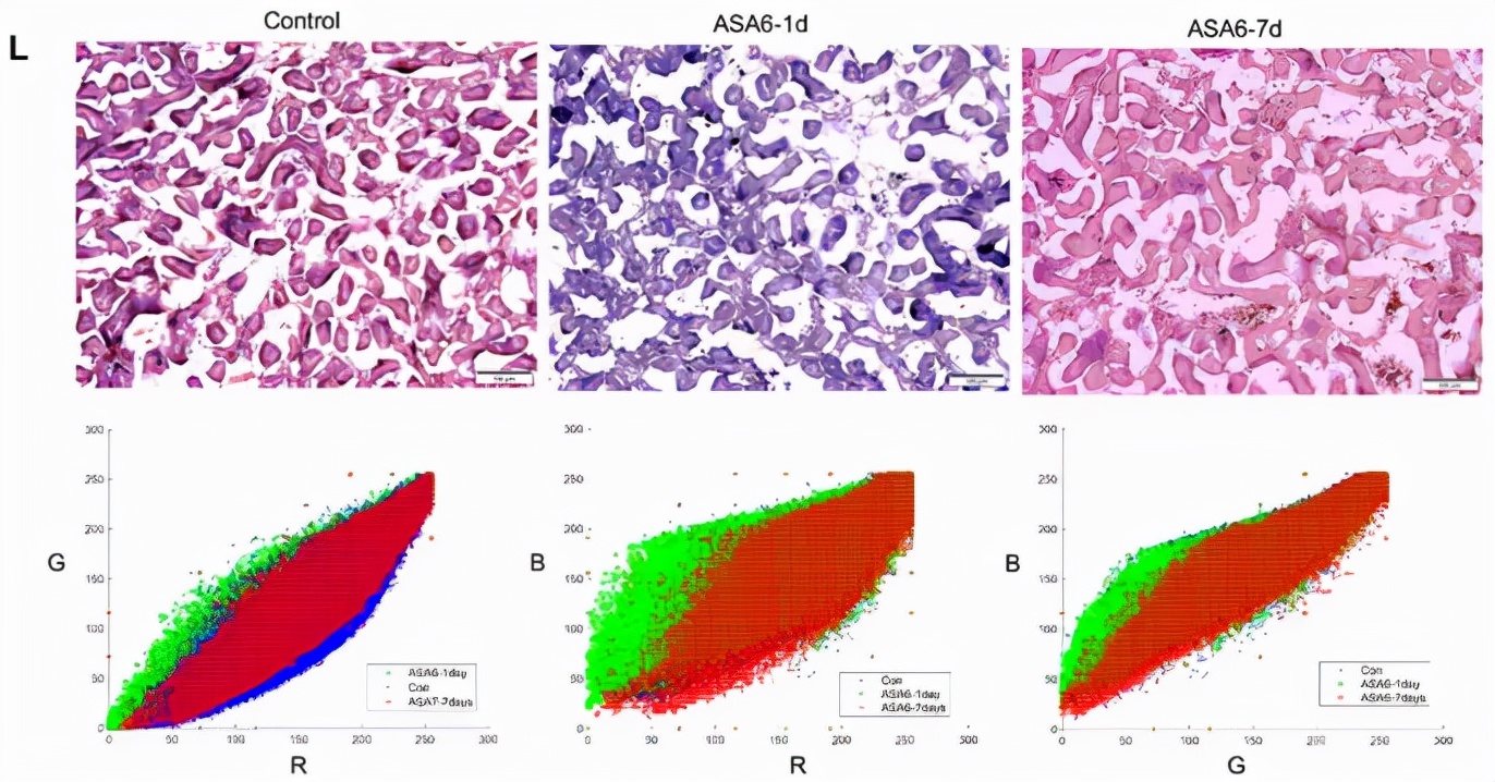 动脉粥样硬化靶向特效药,动脉粥样硬化最新药物研究