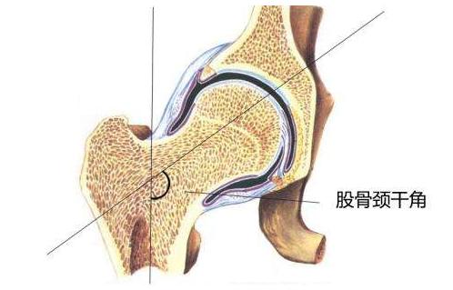 躺在床上矫正小腿外翻,小腿外翻如何矫正和站立