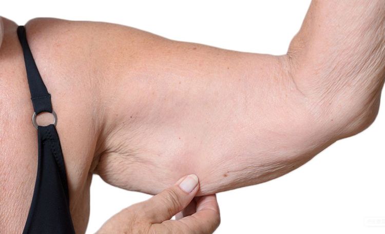 患了肌少症如何纠正,肌少症引发多项健康观念改变