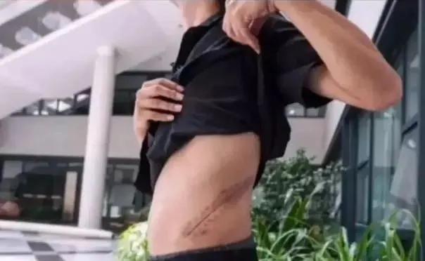 卖肾换苹果手机的高中生,高中生卖肾换iphone手机