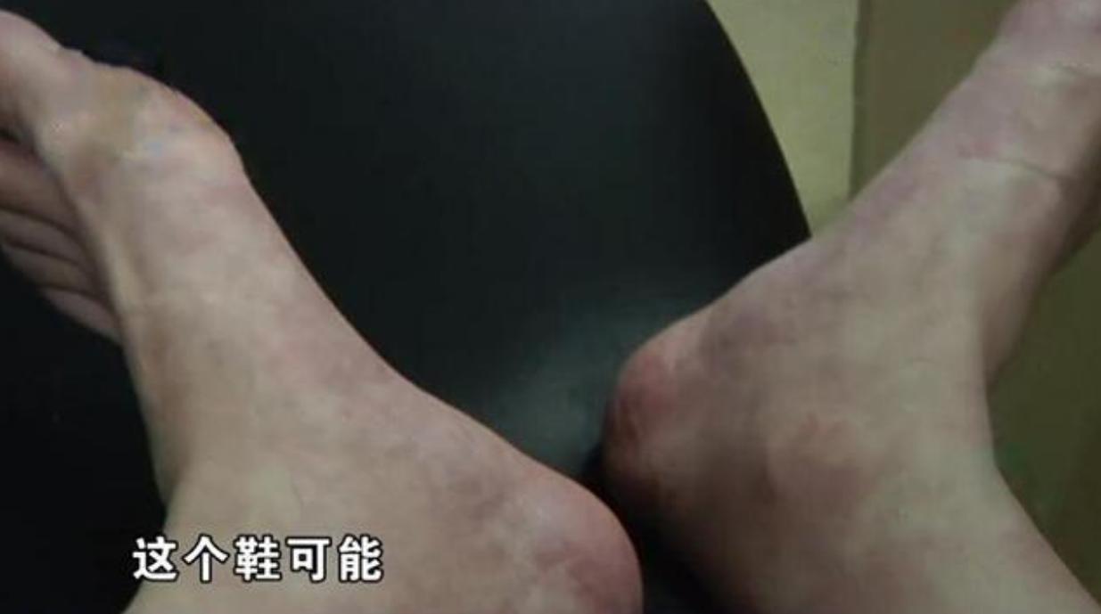 花569元买的“匡威”，刚穿一天脚肿了？店长：比如说吃芒果