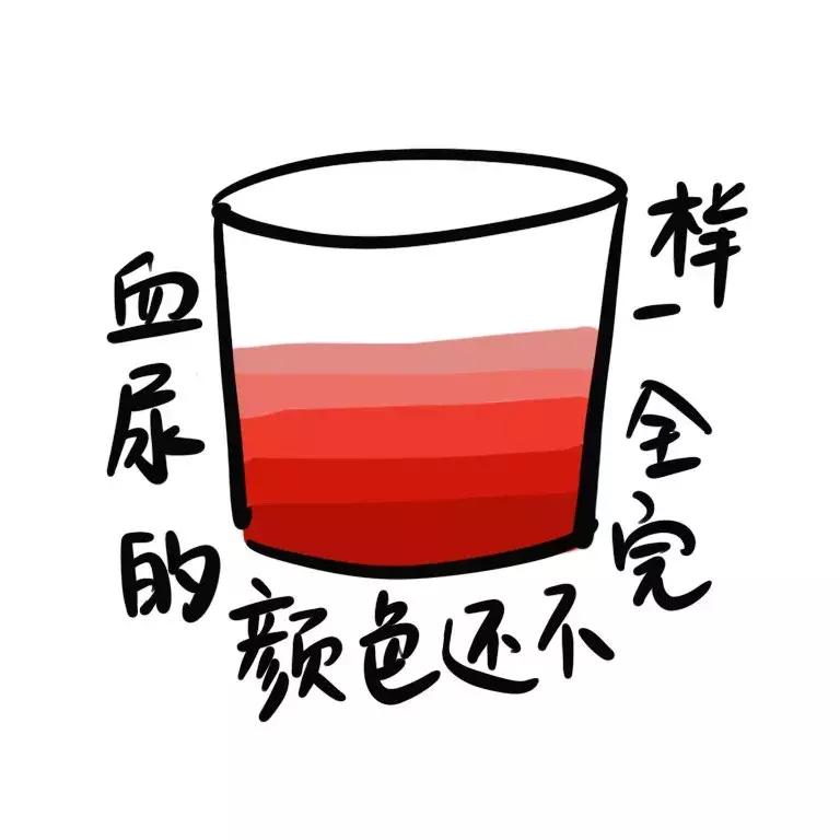 尿液颜色反映的疾病,尿液变成这5种颜色暗示大病将至