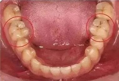 疫情期间无法看牙,疫情期间没看好的牙怎么办