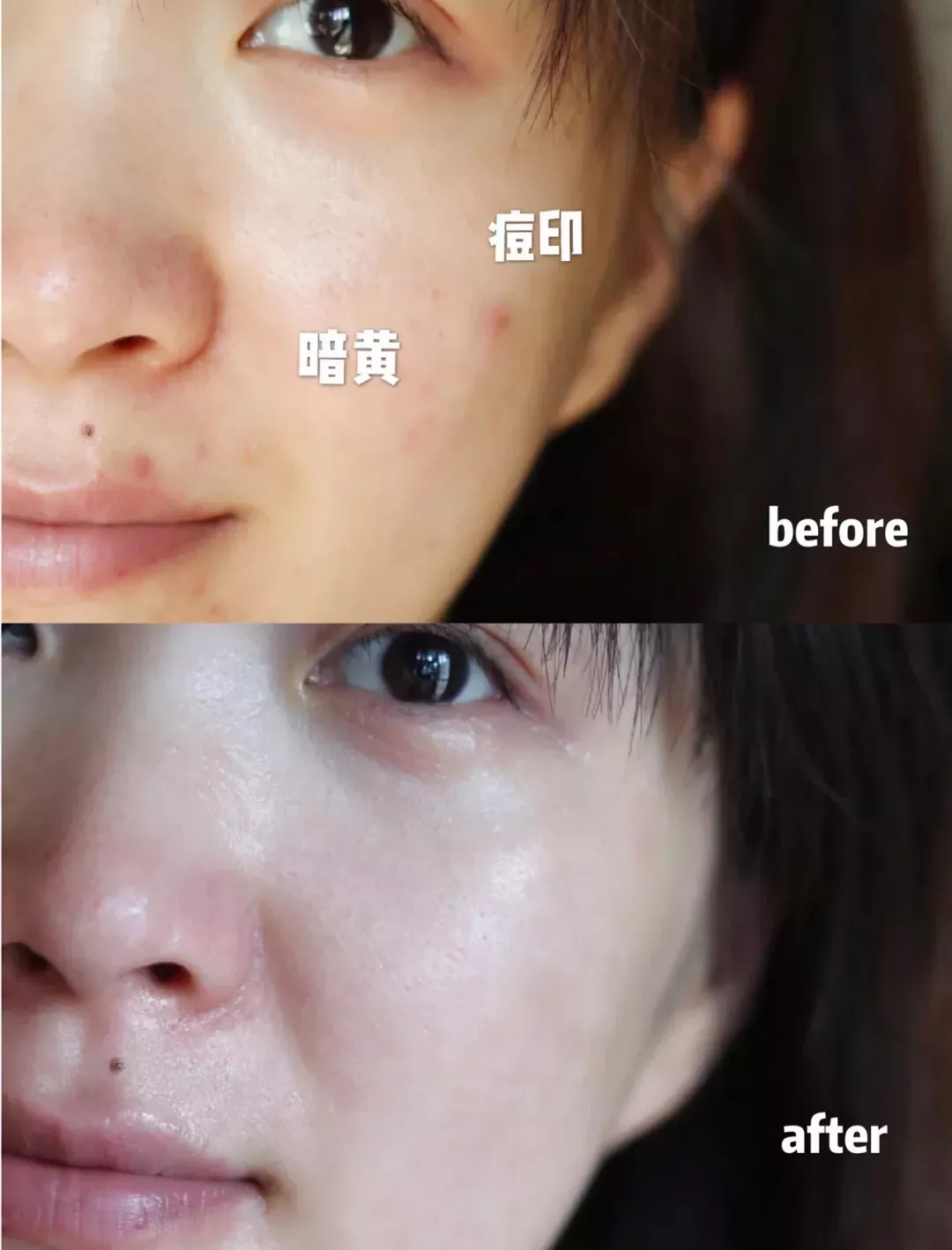 去黄提亮紧致茶面膜,韩国茶树面膜