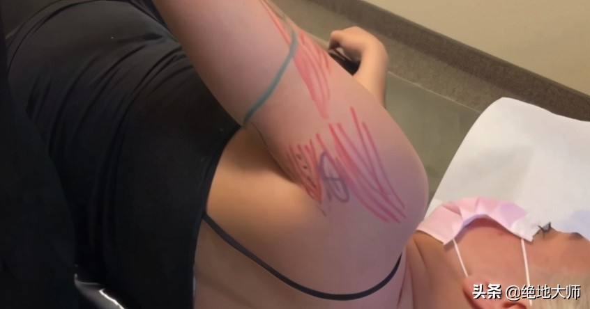 手神经外伤康复视频,治疗手神经损伤的药