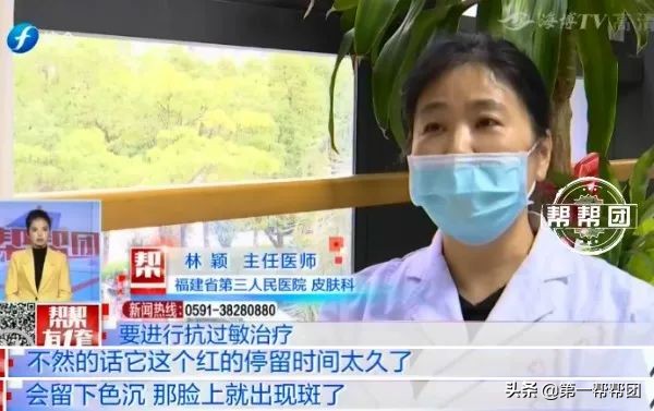 用了面膜皮肤变黑又脱皮,网红面膜变成激素皮炎