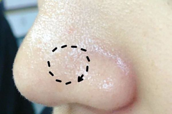 凡士林在脸上有副作用吗,凡士林能美容吗