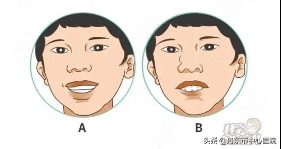 市民业余学习行动|腺样体肥大——关注儿童睡眠质量
