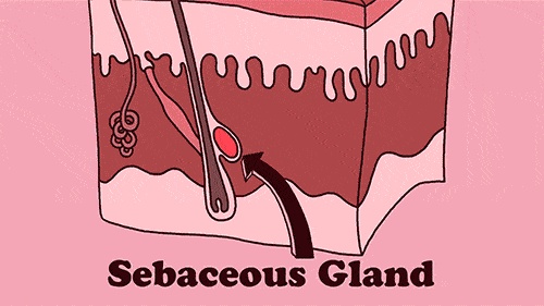 丘疹性痘痘肌肤怎么治疗,如何彻底根治丘疹型痘痘