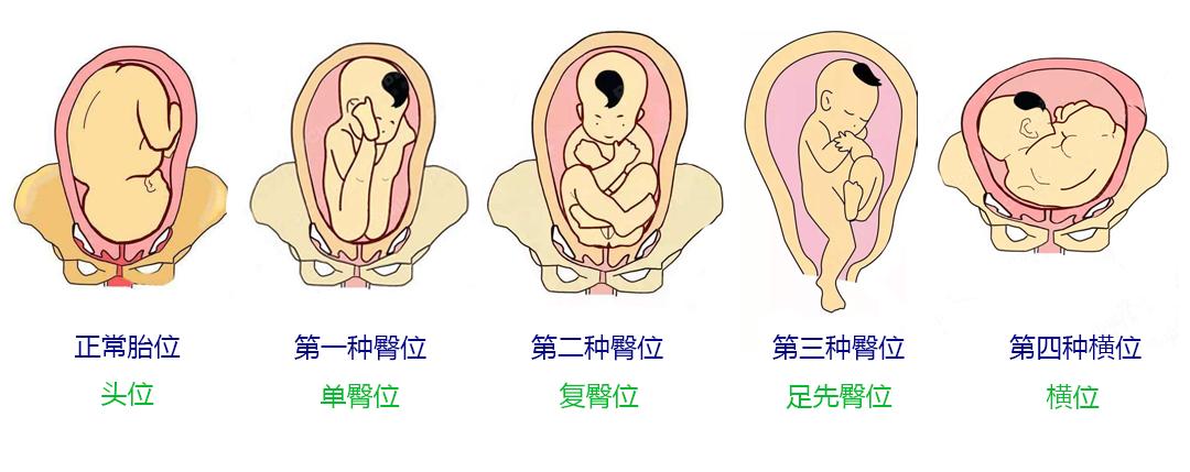 快到预产期的孕妈们,快到预产期的宝妈
