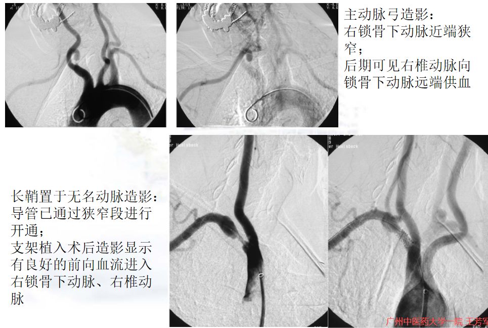 一手防守一手攻击防身术,一手持棒一手握盾训练