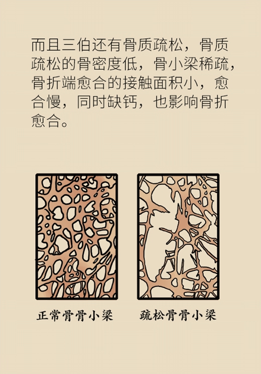 老人崴脚为什么好得慢,中老年人崴脚怎么办