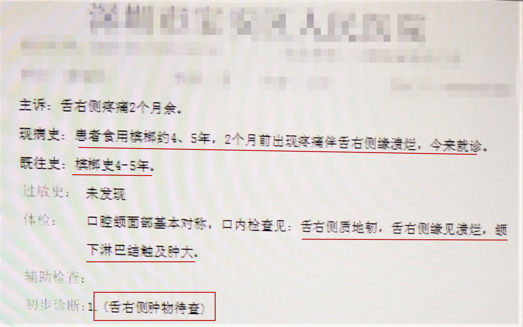 吃槟榔是需要削骨吗,吃槟榔用剥皮吗