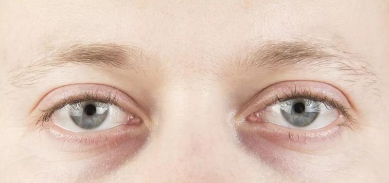 学她这样保养，50岁都不会有黑眼圈，秘密全靠这支「小黑管」